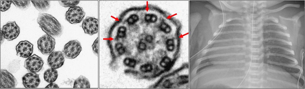Case 4:  Neonate with Respiratory&nbsp;Distress